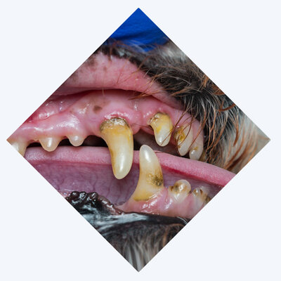 Prevention of Dental Disease